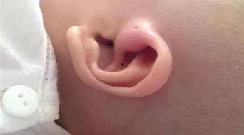 什么耳朵有福气图片,揭秘寓意吉祥的耳朵形象